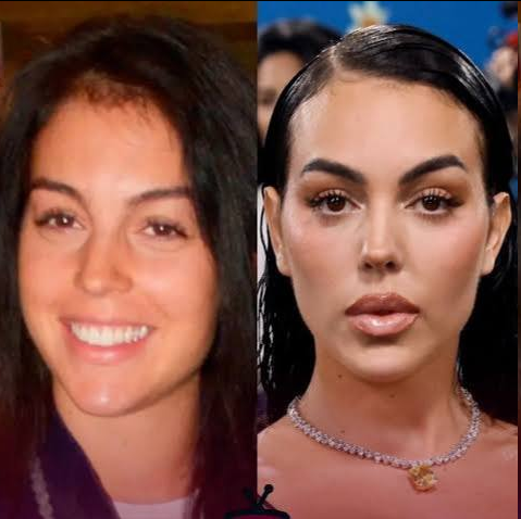 عکس| جورجینا قبل و بعد از عمل