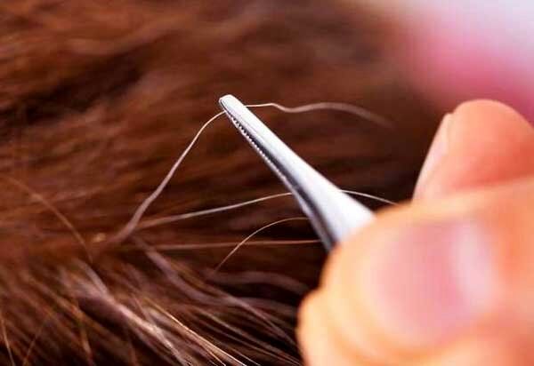 آیا میتوان جلوی سفید شدن موها را گرفت؟/ دلیل سفیدی مو در نواحی شقیقهها چیست؟/ چه دارو و مکملی اثر قطعی بر رفع سفیدی مو دارد؟